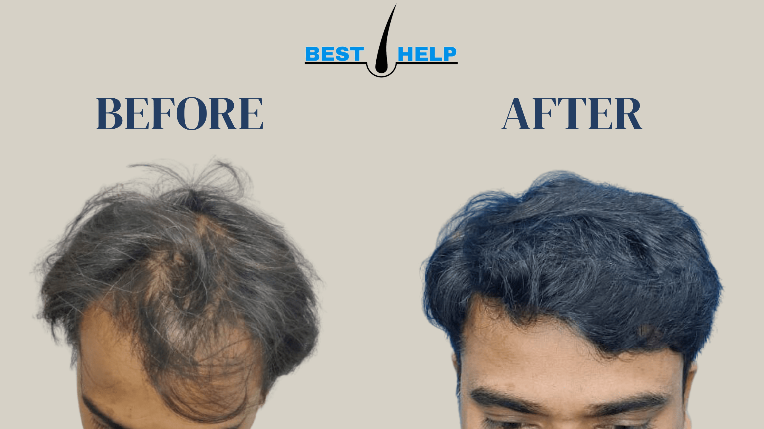 November 2021 – Best Hair Help