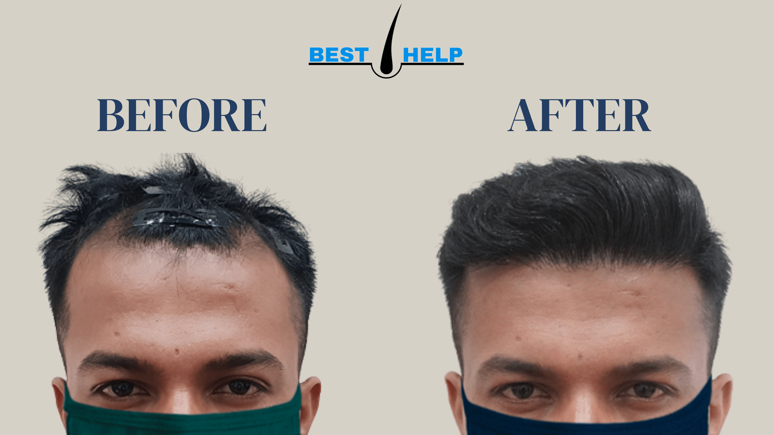 Hair and Shape Clinic Mumbai Reviews – Best Hair Help
