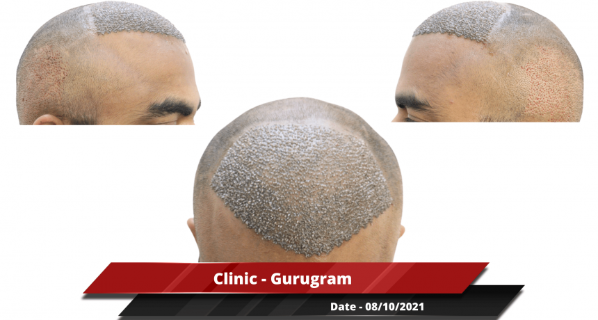 Clinic - Gurugram-min