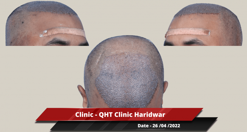 Clinic - QHT Clinic Haridwar-min